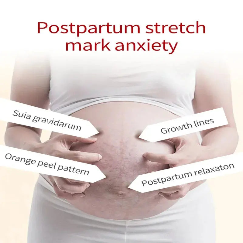Image of Reborn Baby Dolls 7 Days Stretch Marks Cream For Pregnancy Remove