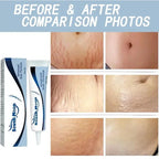 Image of Reborn Baby Dolls 7 Days Stretch Marks Cream For Pregnancy Remove