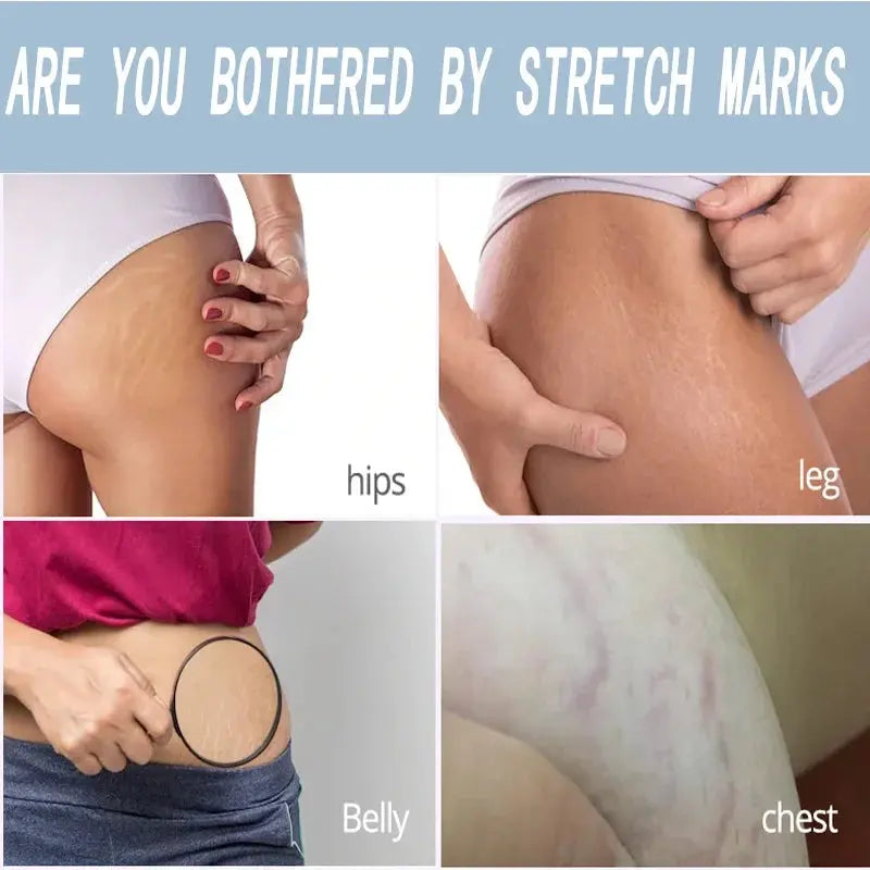 Image of Reborn Baby Dolls 7 Days Stretch Marks Cream For Pregnancy Remove
