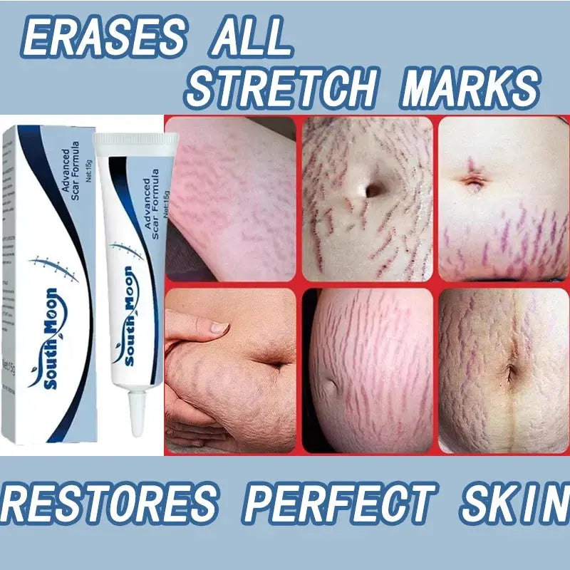 Image of Reborn Baby Dolls 7 Days Stretch Marks Cream For Pregnancy Remove