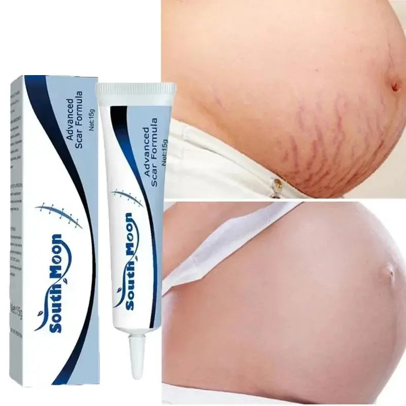 Image of Reborn Baby Dolls 7 Days Stretch Marks Cream For Pregnancy Remove