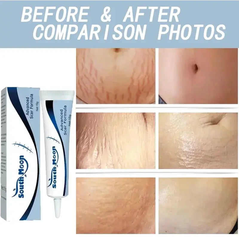 Image of Reborn Baby Dolls 7 Days Stretch Marks Cream For Pregnancy Remove