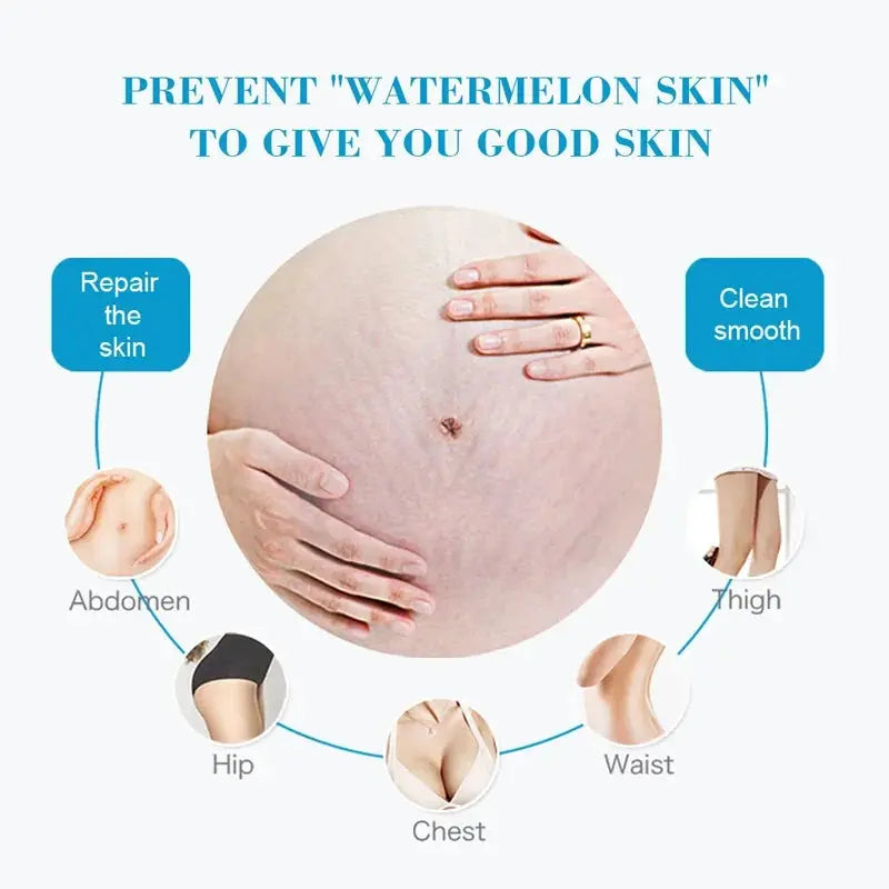 Image of Reborn Baby Dolls 7 Days Stretch Marks Cream For Pregnancy Remove