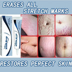 Image of Reborn Baby Dolls 7 Days Stretch Marks Cream For Pregnancy Remove
